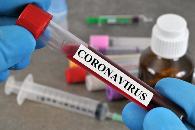 Coronavirus : plusieurs personnes infectées par le virus en région liégeoise