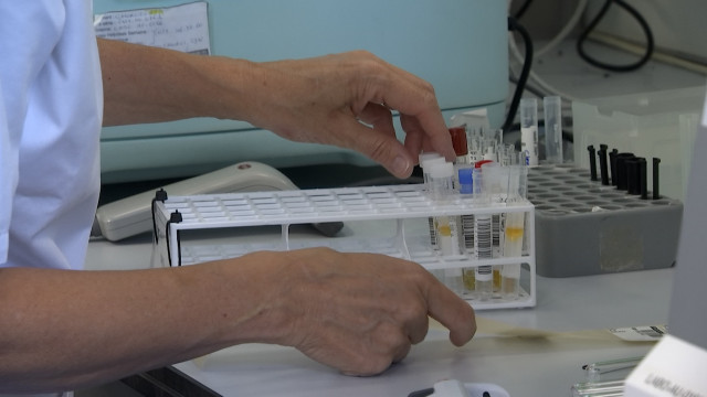 330 cas de variole du singe en Belgique: des spécialistes liégeois rassurent